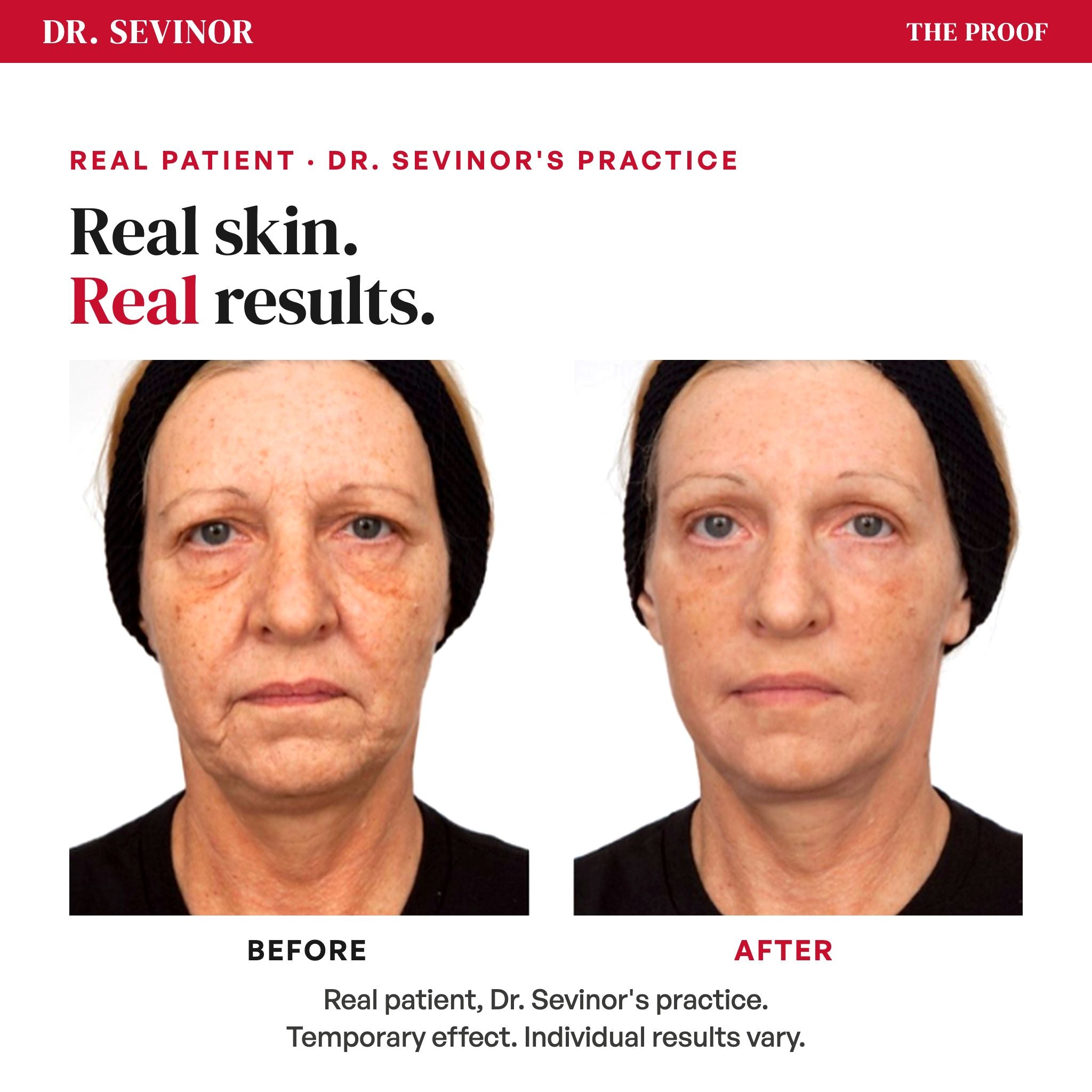 Wrinkle Solution — proof