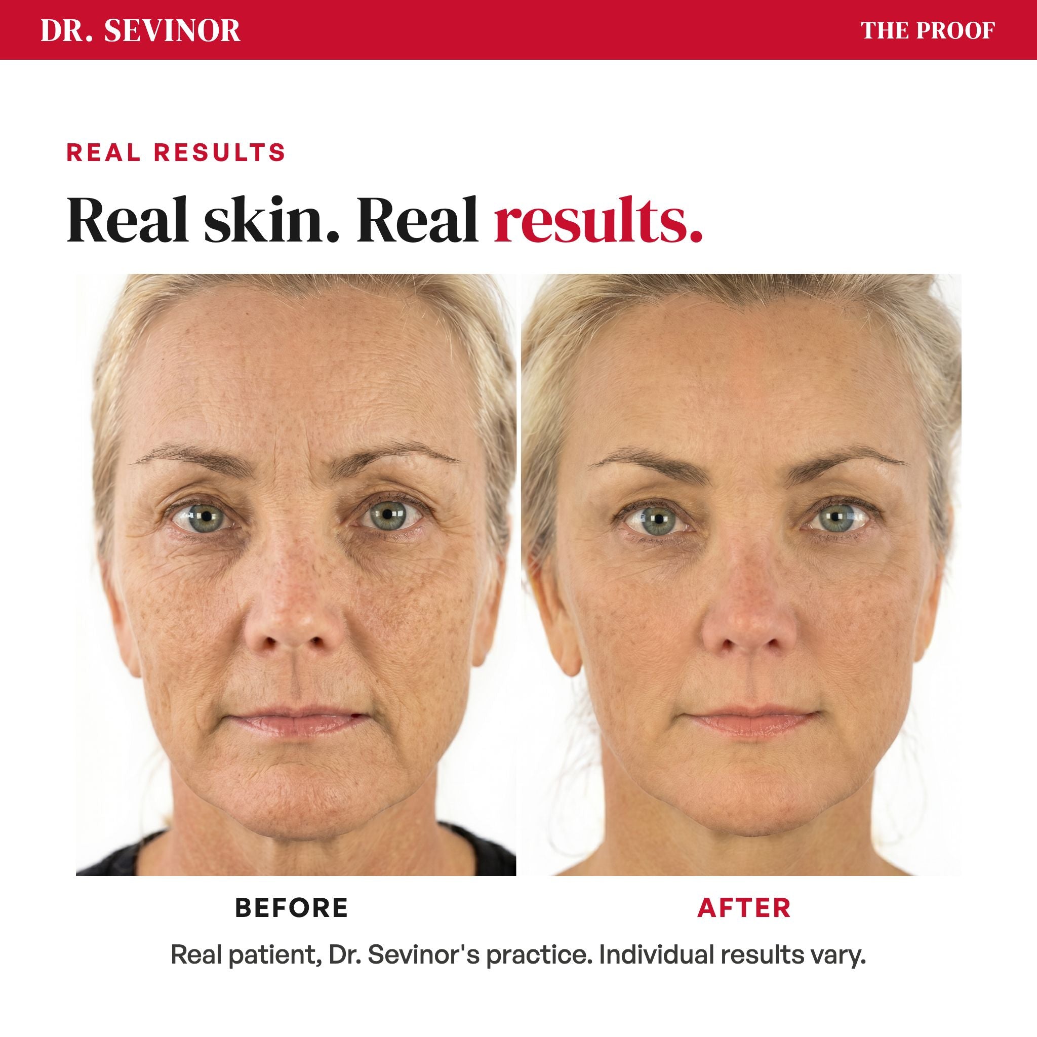 Concentrated Serum — proof