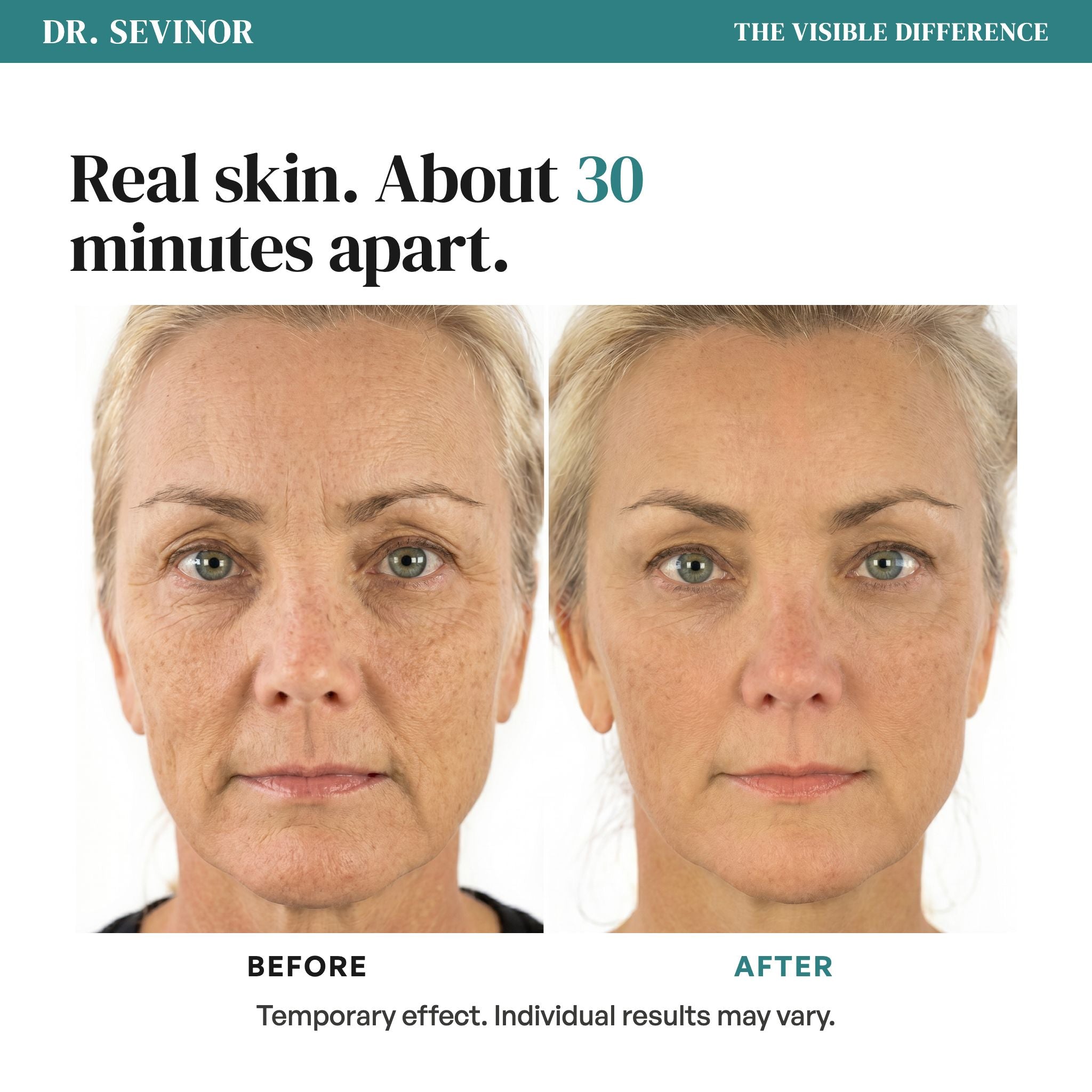 Face Lift Solution — proof