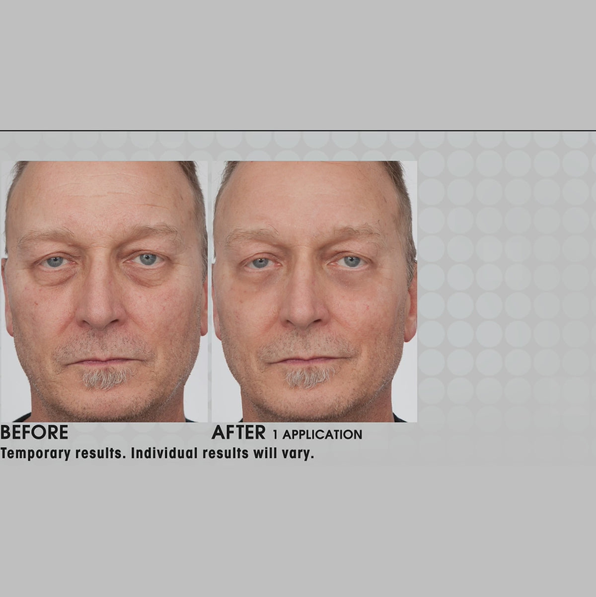 3 Minute Wrinkle Solution — video