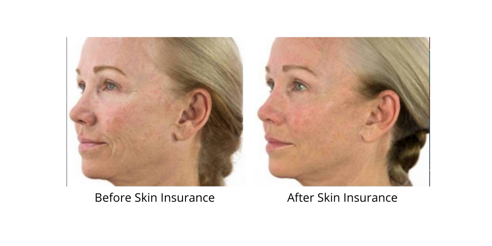 Before and after — real product user