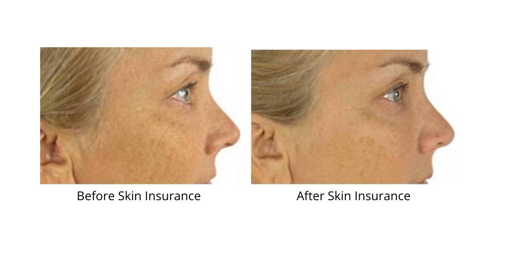 Before and after — real product user