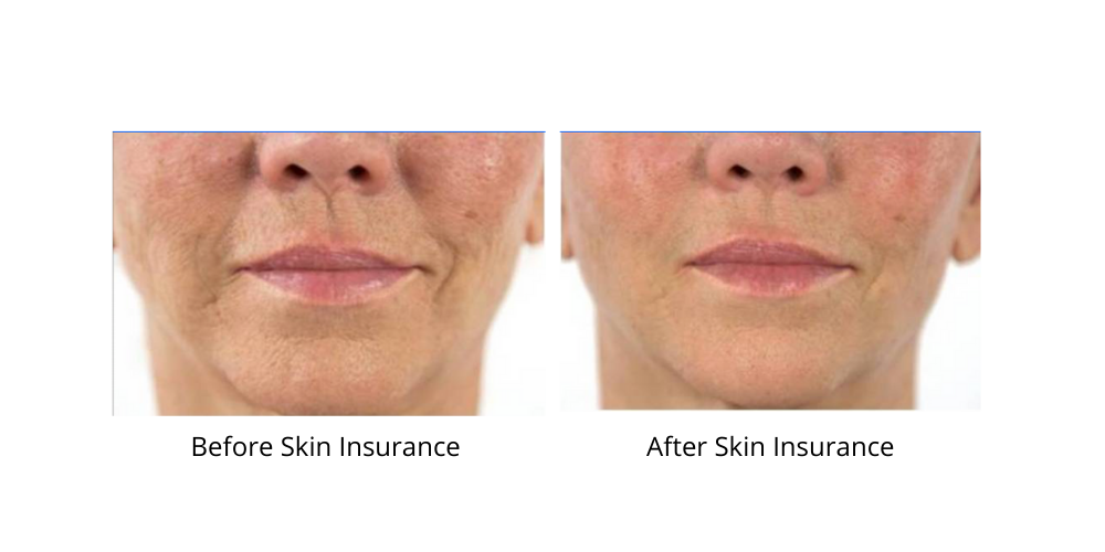 Before and after — real product user