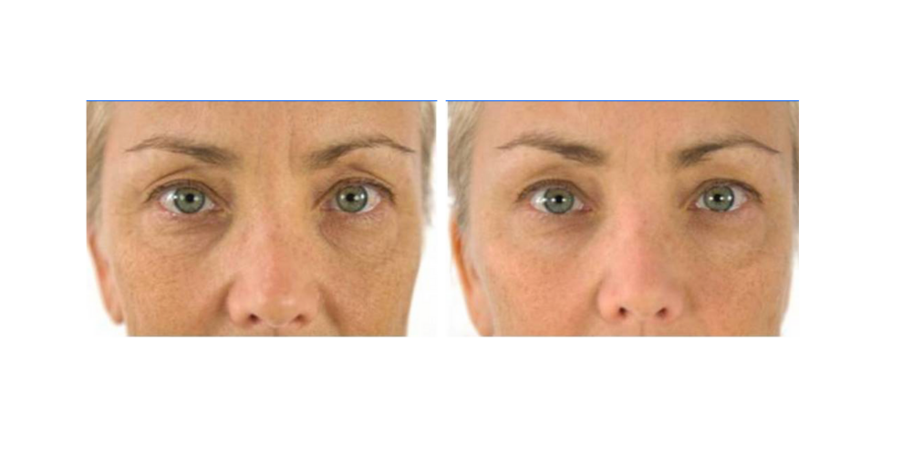Before and after — real product user