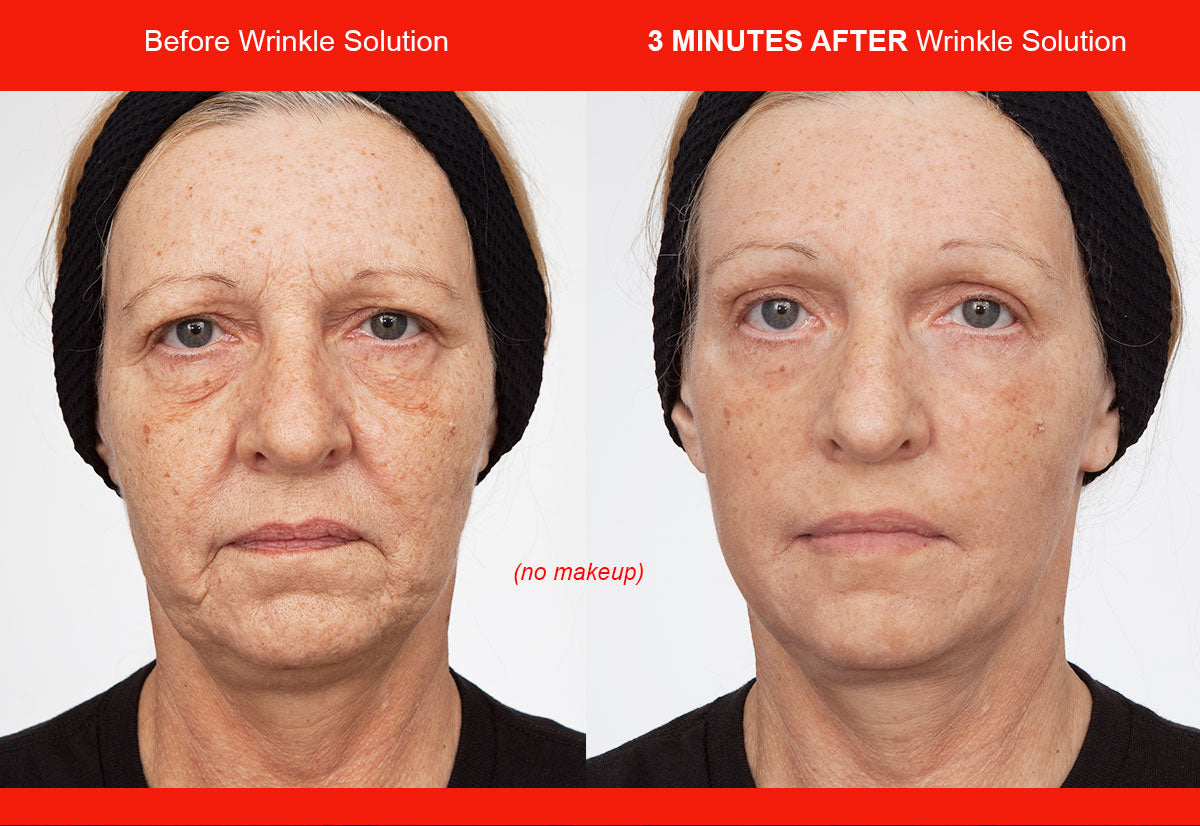Before and after — real product user