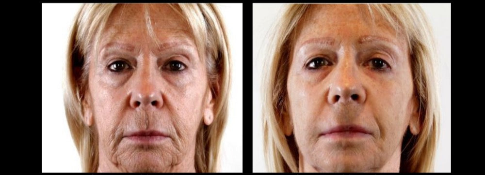 Before and after — real product user