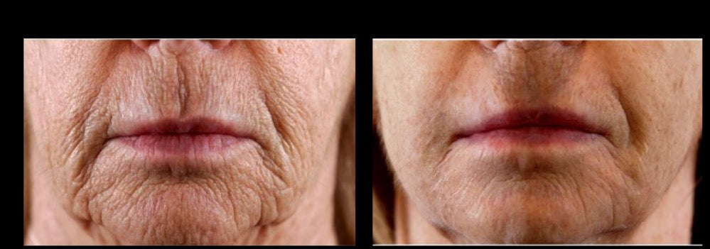 Before and after — real product user