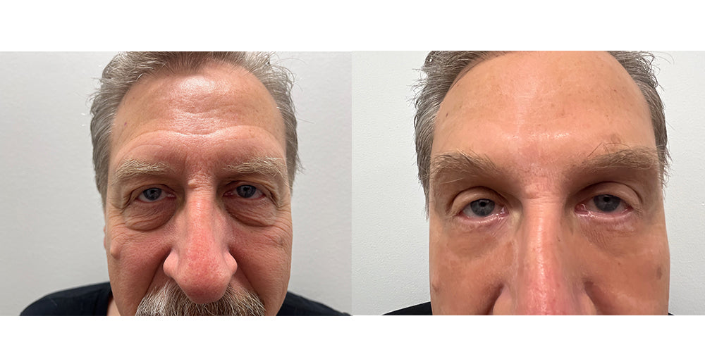 Before and after — real product user